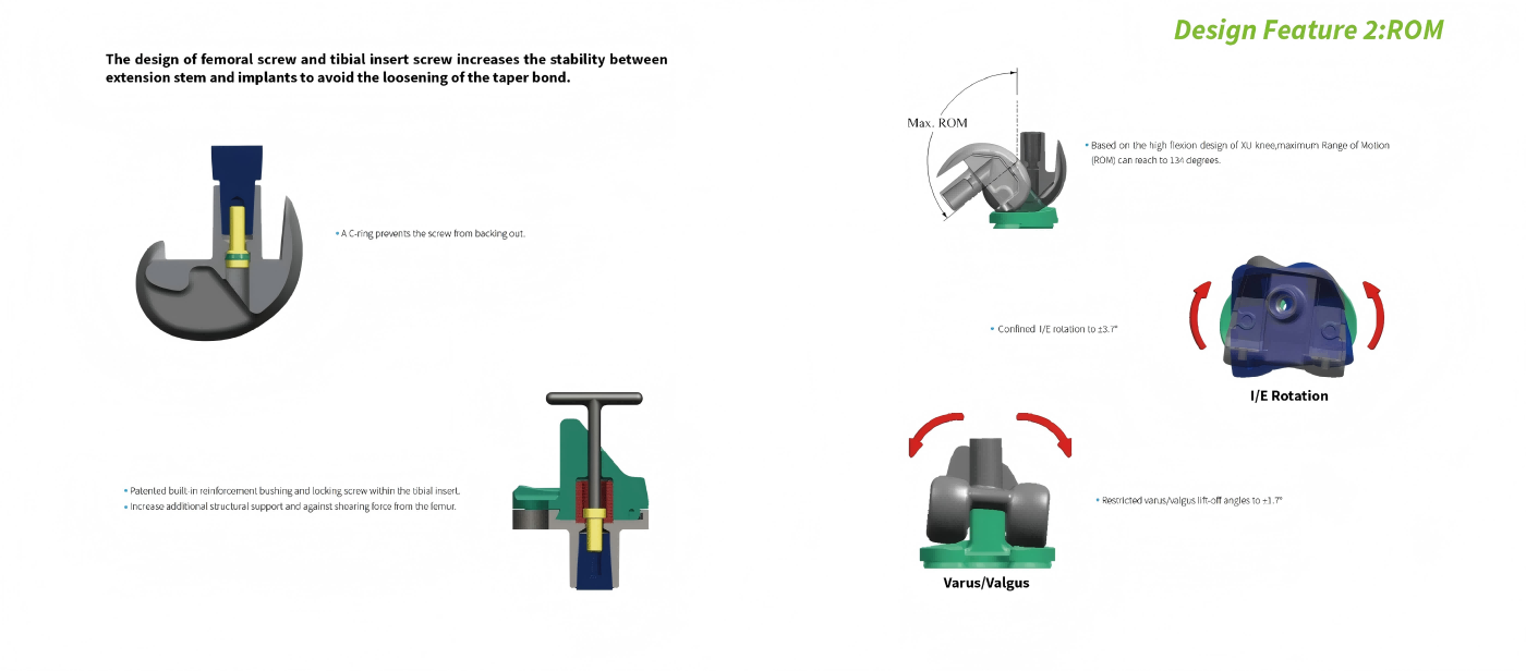 Mobile Bearing (MB) rotating knee replacement,rotating platform total knee replacement (1).png