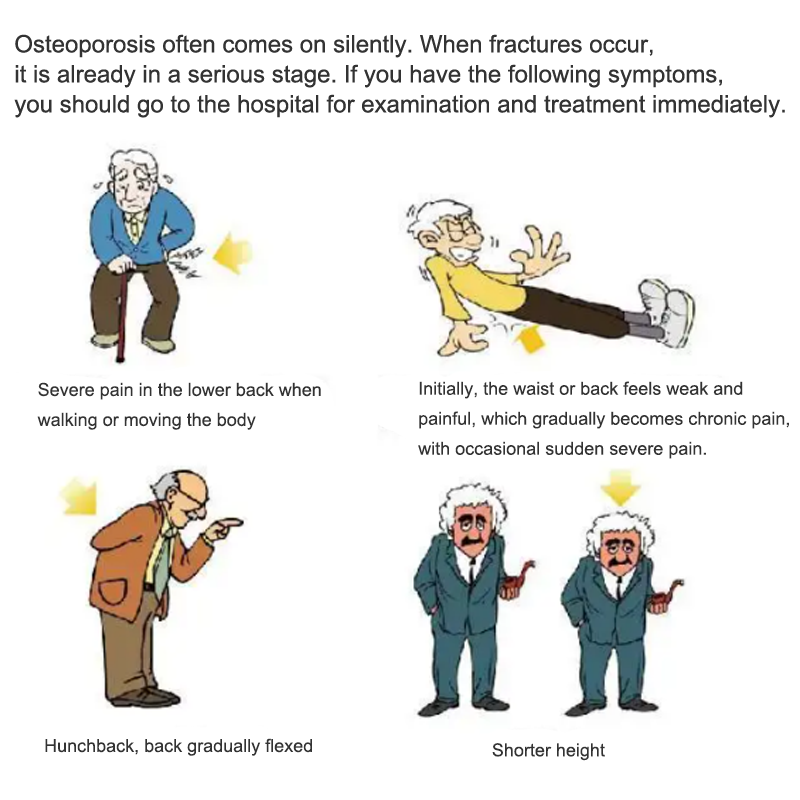 Hazards of Osteoporosis