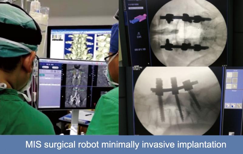 orthopedic surgical robot