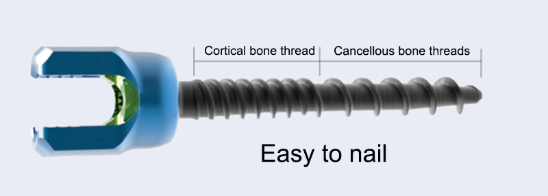 Screw Thread Cortical Bone / Cancellous Bone Dual Thread