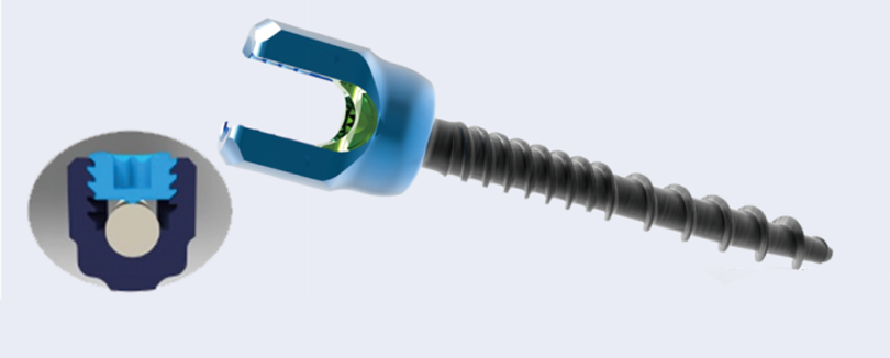 negative-angle thread design screw
