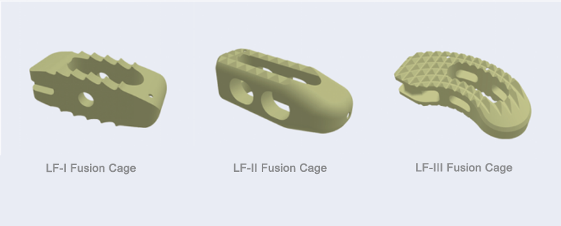 Lumbar Fusion Cage