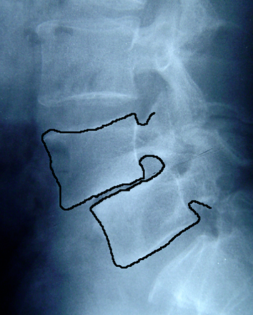 Classification and Grading