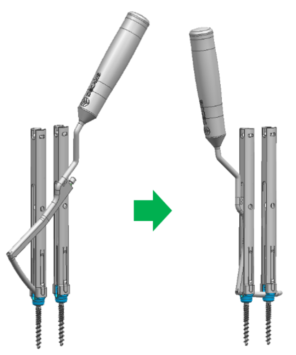 Rod Placement Simplified