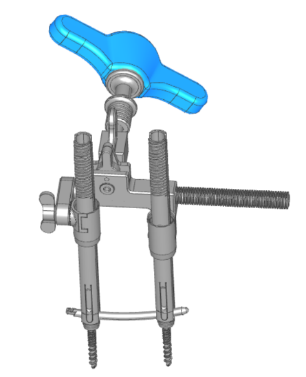 Cross-Segment Distraction/Compression