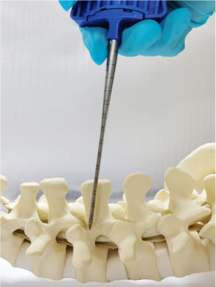 Initial trocar placement and positioning