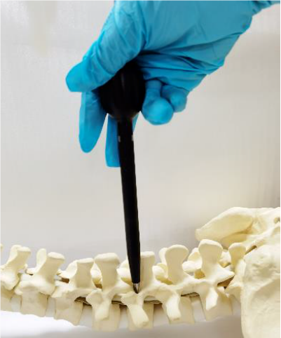 Place dilating tubes