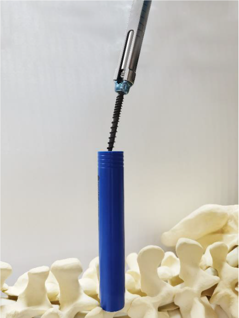 Insert pedicle screw