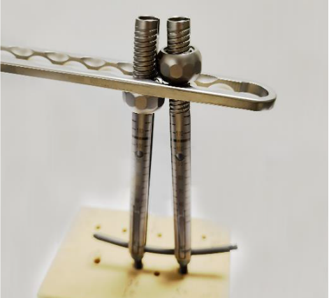 Reduce the spondylolisthetic