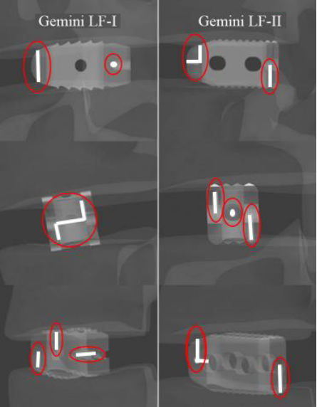 Gemini LF-I、II