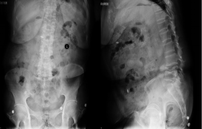 Preoperative Imaging