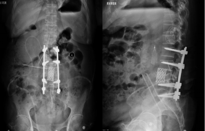 Preoperative Imaging