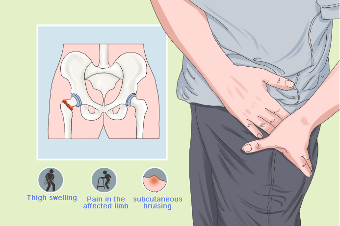 Hip joint disease