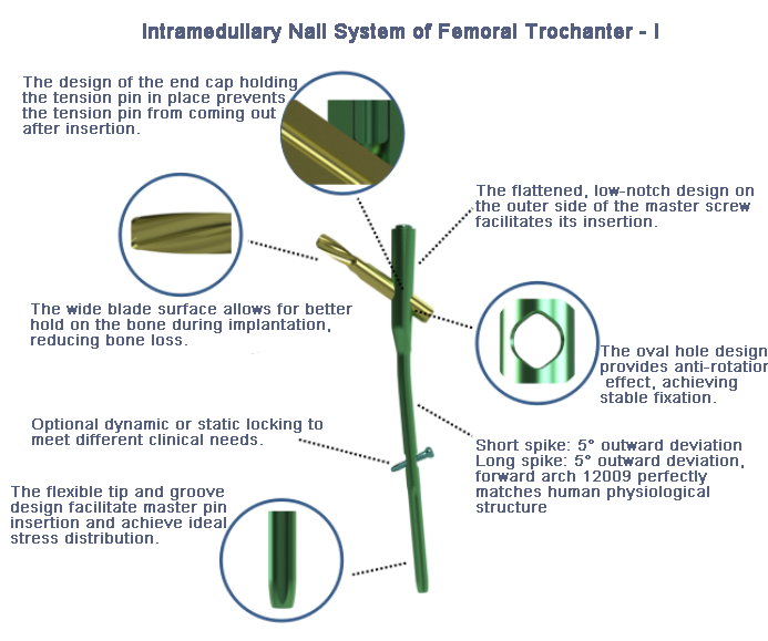 Intramedullary Nall System of Femoral Trochanter -l
