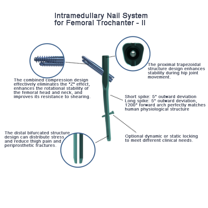Intramedullary Nall System of Femoral Trochanter -lI