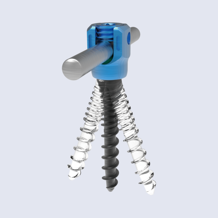 β-Angle Monoplanar Screw