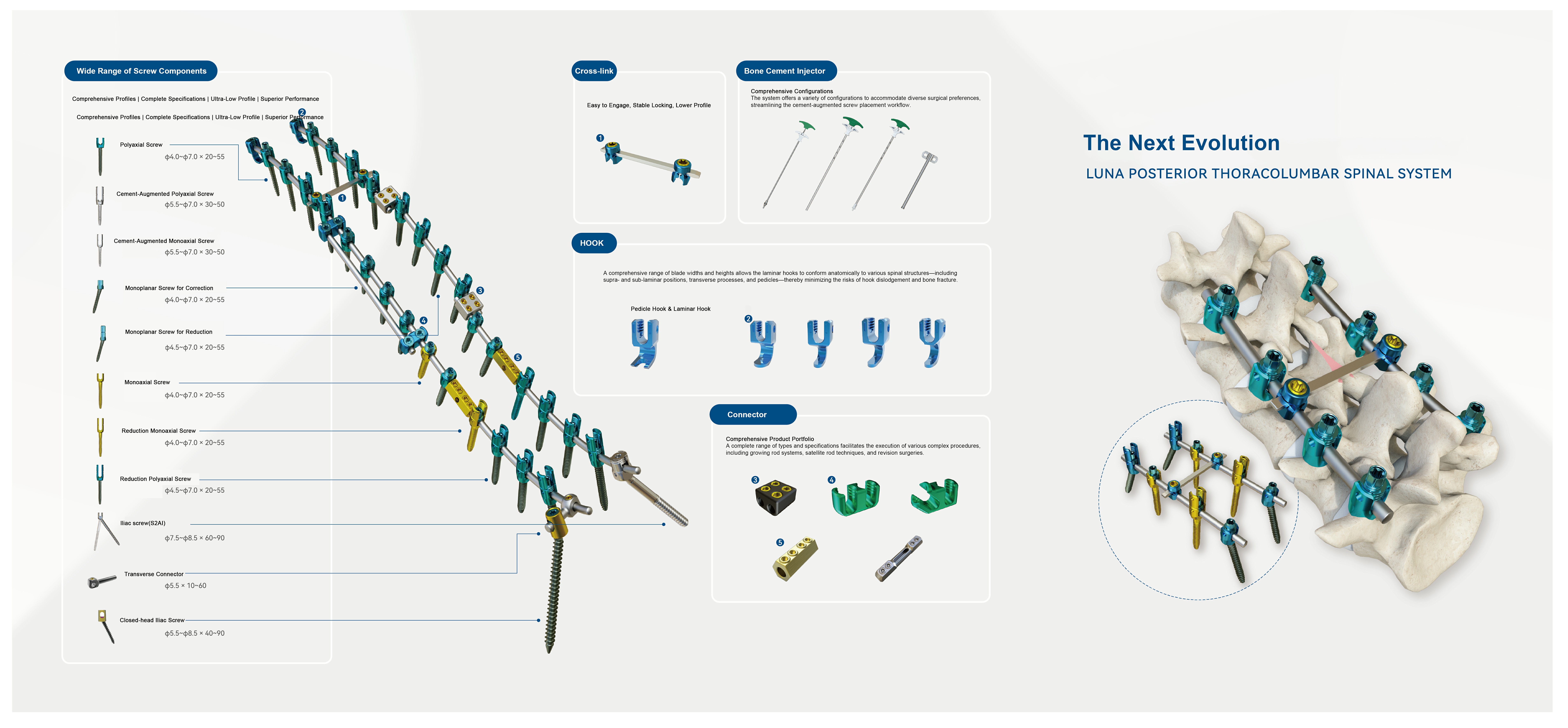 Luna Posterior Thoracolumbar Spinal System