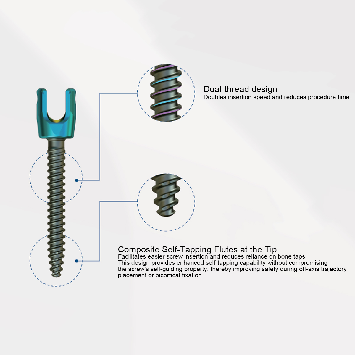 Luna Posterior Thoracolumbar Spinal System