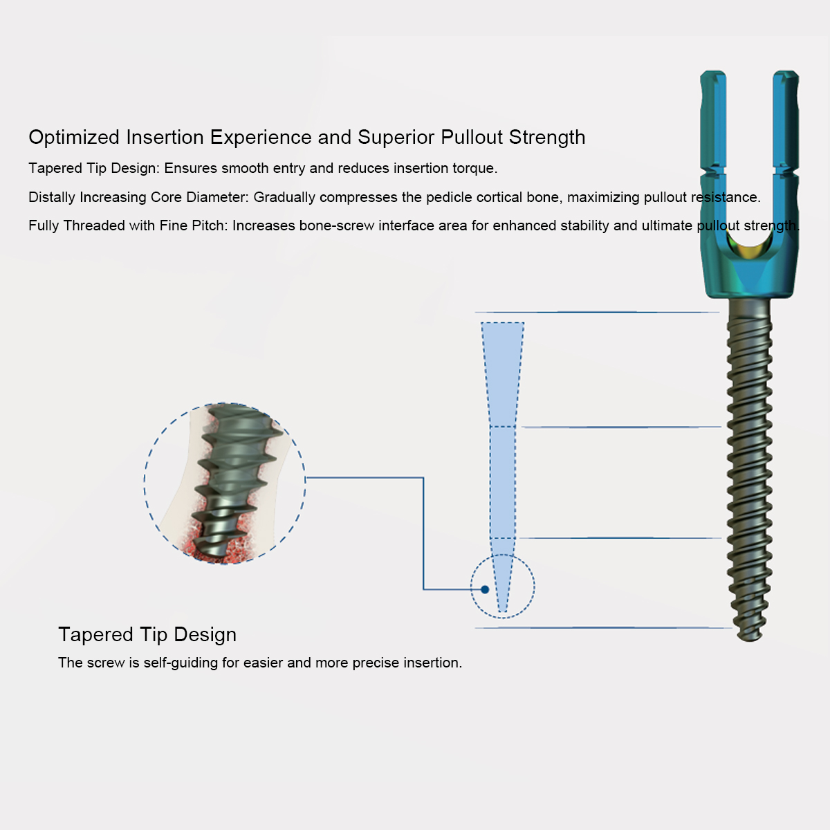Luna Posterior Thoracolumbar Spinal System