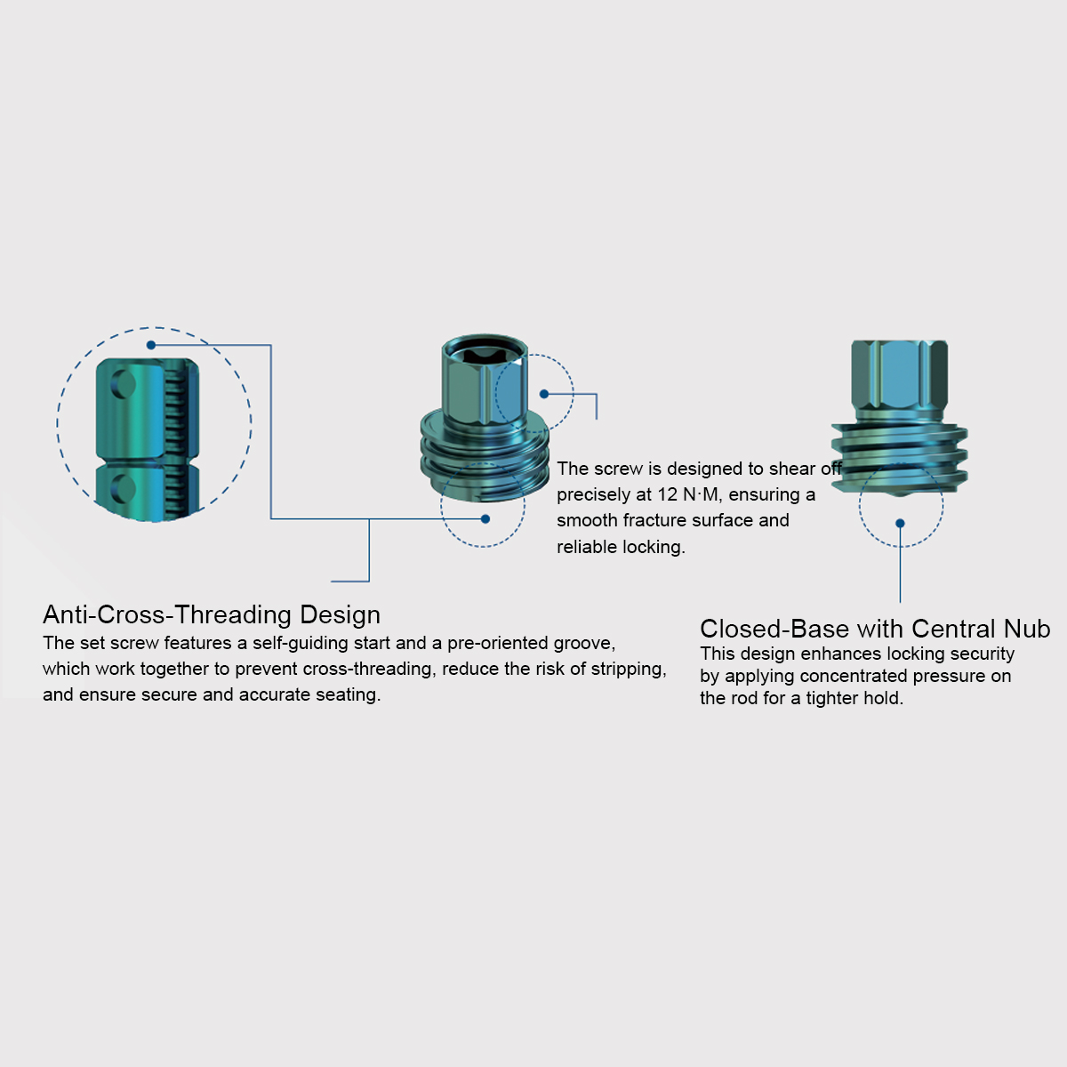 Luna Posterior Thoracolumbar Spinal System