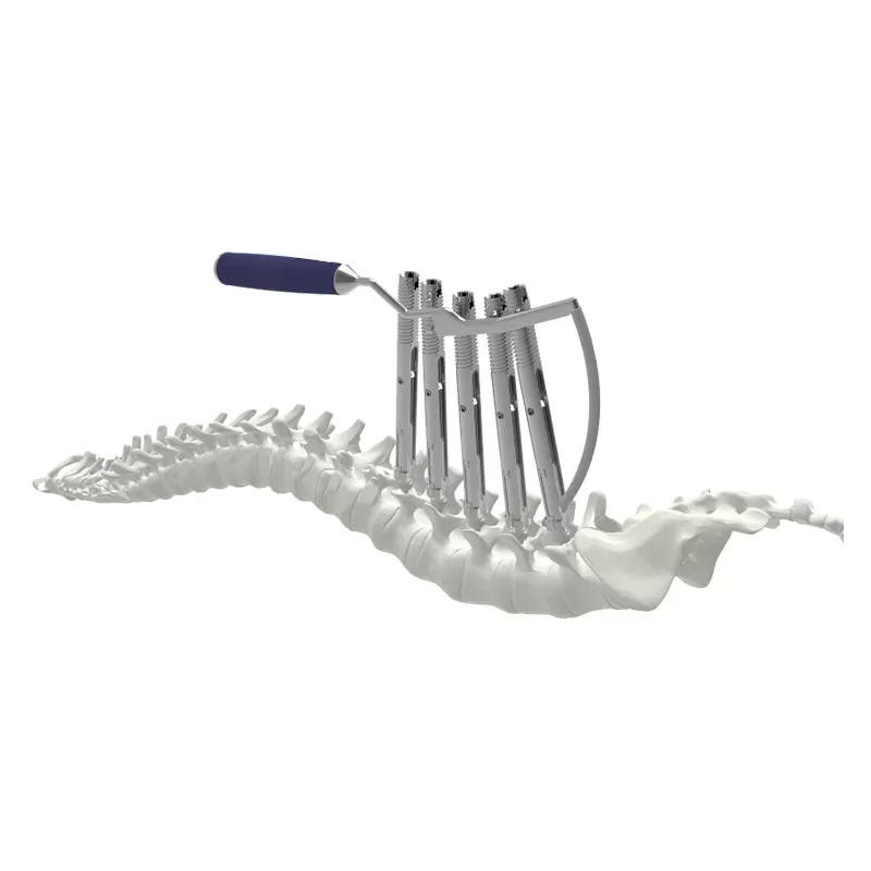 Key Factors Buyers Should Evaluate When Choosing Spinal Fusion Implants