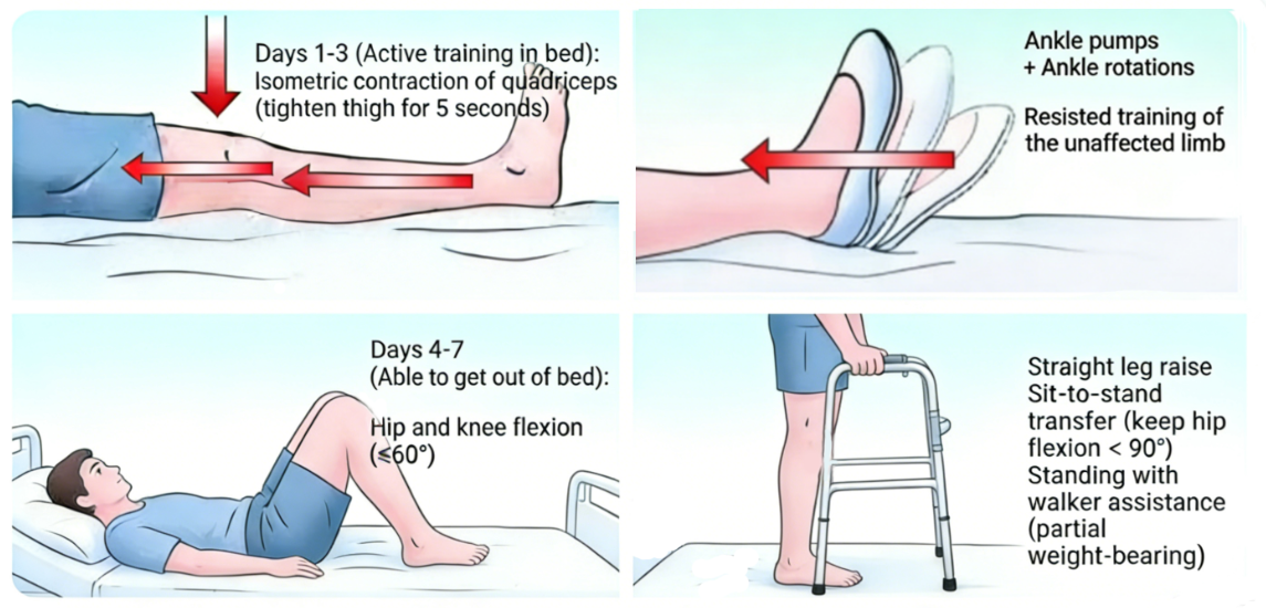 Rehabilitation Training Necessary