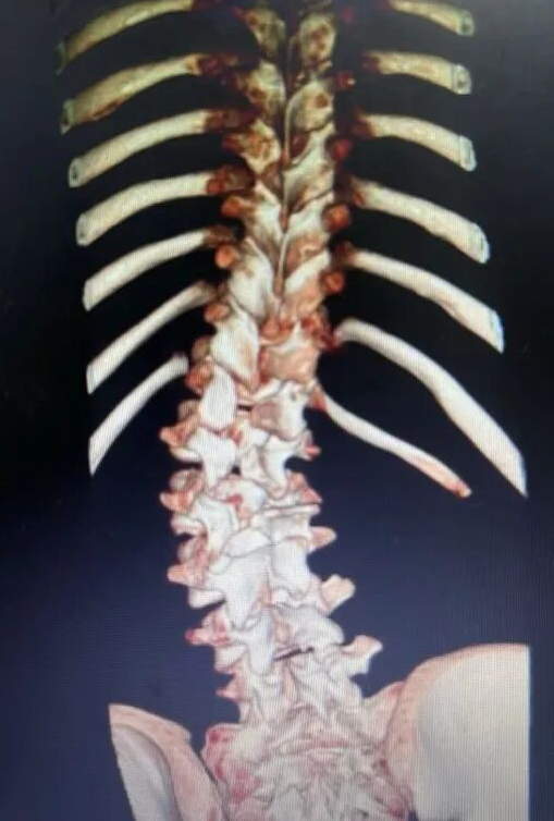 3D Reconstructed Image