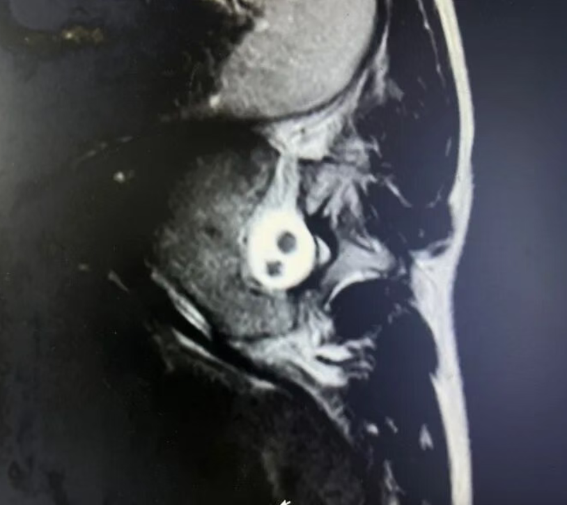 Magnetic resonance imaging