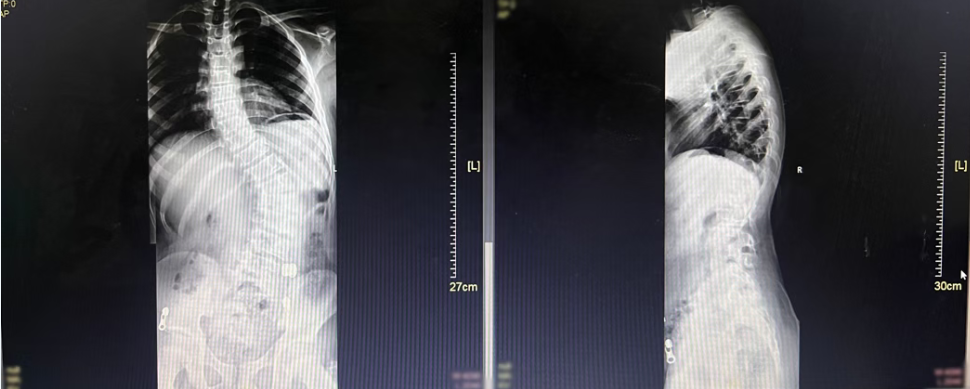 X-ray Image