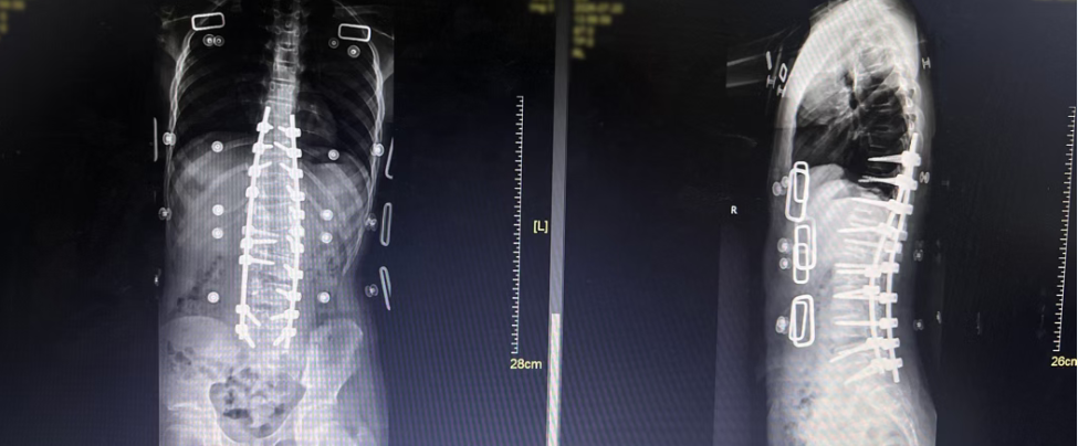 Postoperative Images