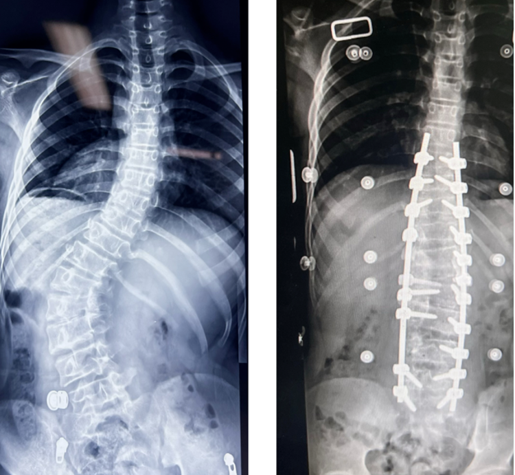 Comparison of images of patients before and after surgery