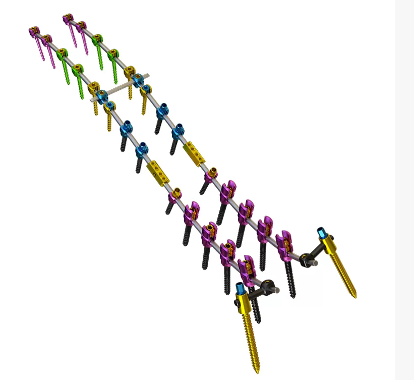 Posterior Thoracolumbar Spinal System