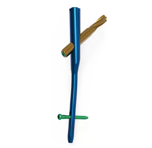Proximal Femoral Nail