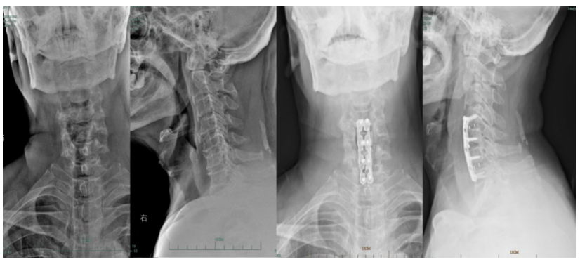 Plain Radiographs