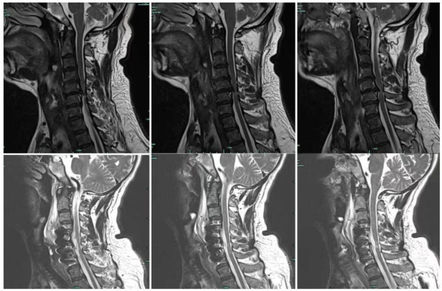 Preoperative MRI images