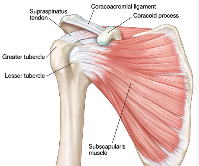 Suture Anchor Repair of Subscapularis Tendon Tears: Arthroscopic Technique and Fixation Considerations
